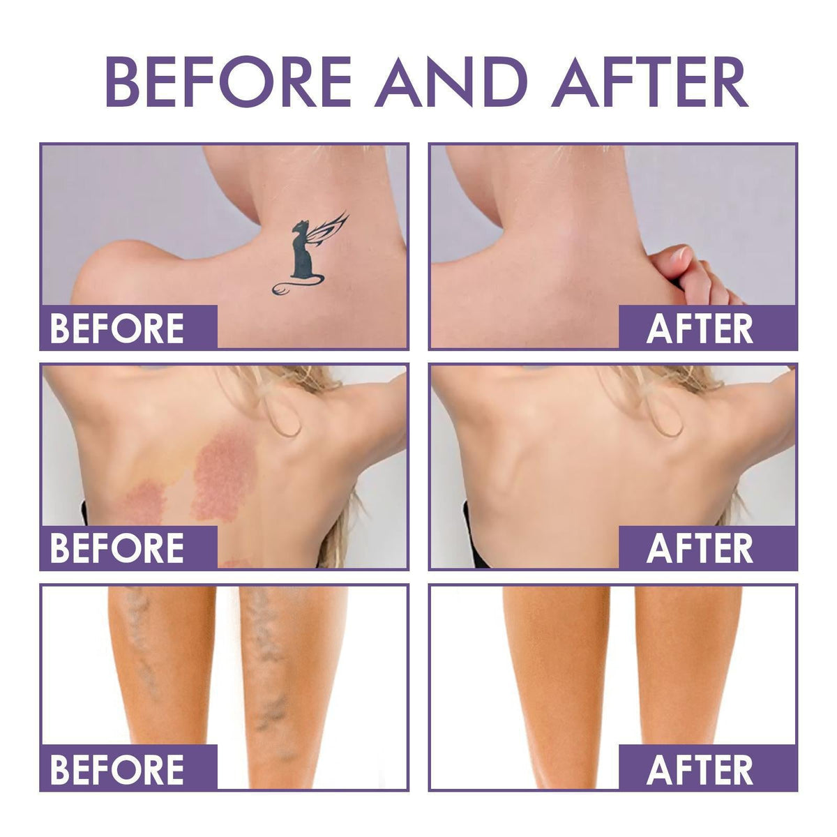 💜Paskutinė diena – pirkite 1, gaukite 1 nemokamai!💜✨Body Perfector – vandeniui atsparus, lengvas ir nepriekaištingas kūno makiažas-LT