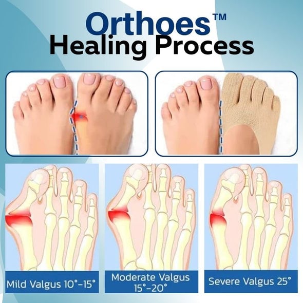 Calcetines ortopédicos Orthoes™-ES