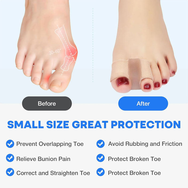 Pirštų separatorius ir hallux valgus korekcija🦶-LT