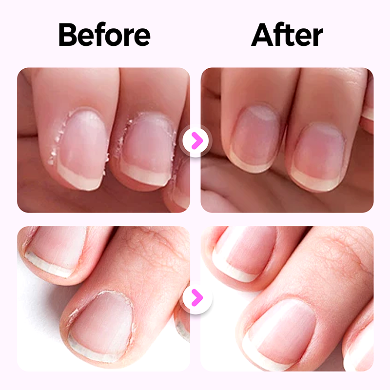 💜Kupite 1, dobite 1 gratis💜2026 Novo in izboljšano pisalo za nohte 3 v 1💅-SI
